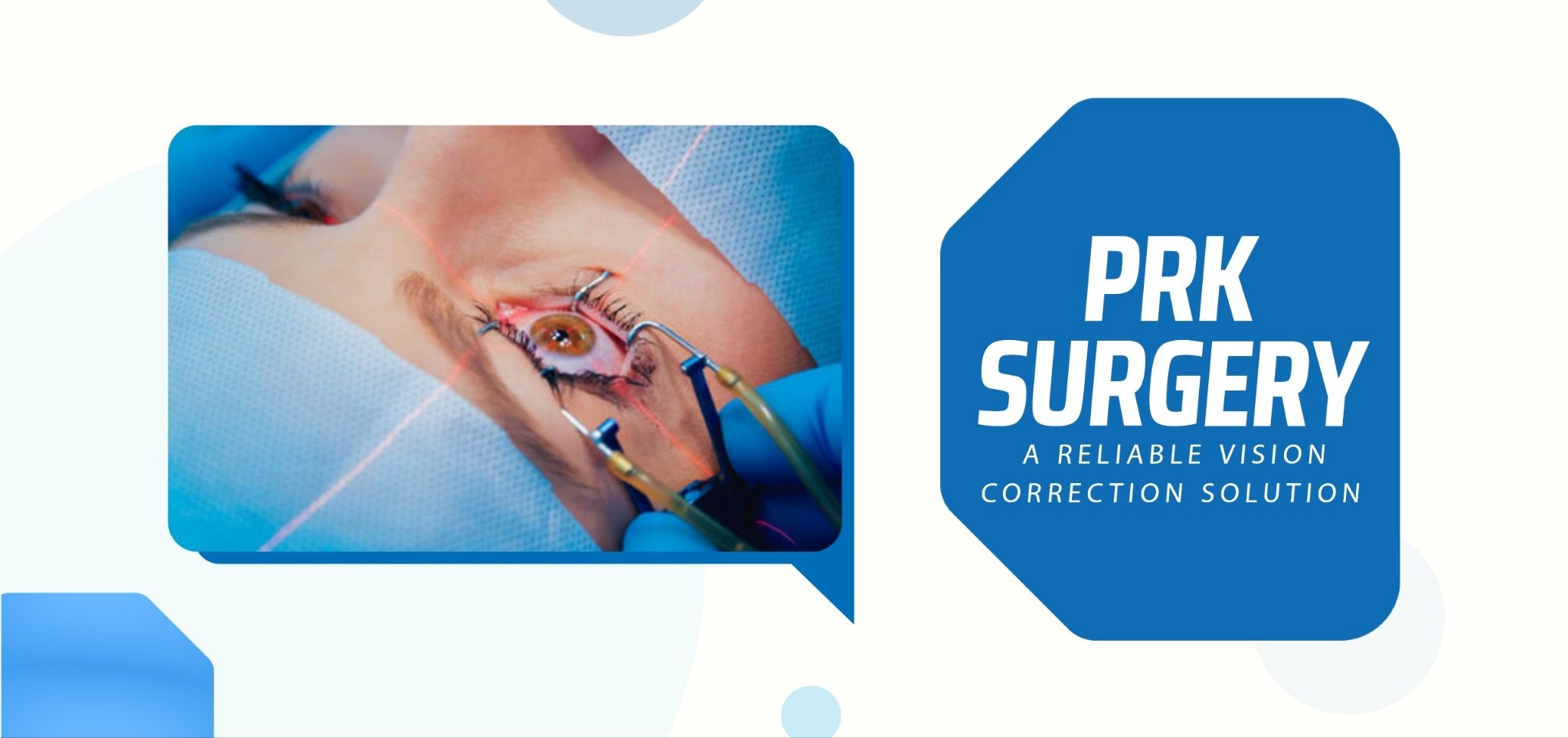 PRK Surgery: A Reliable Vision Correction Solution