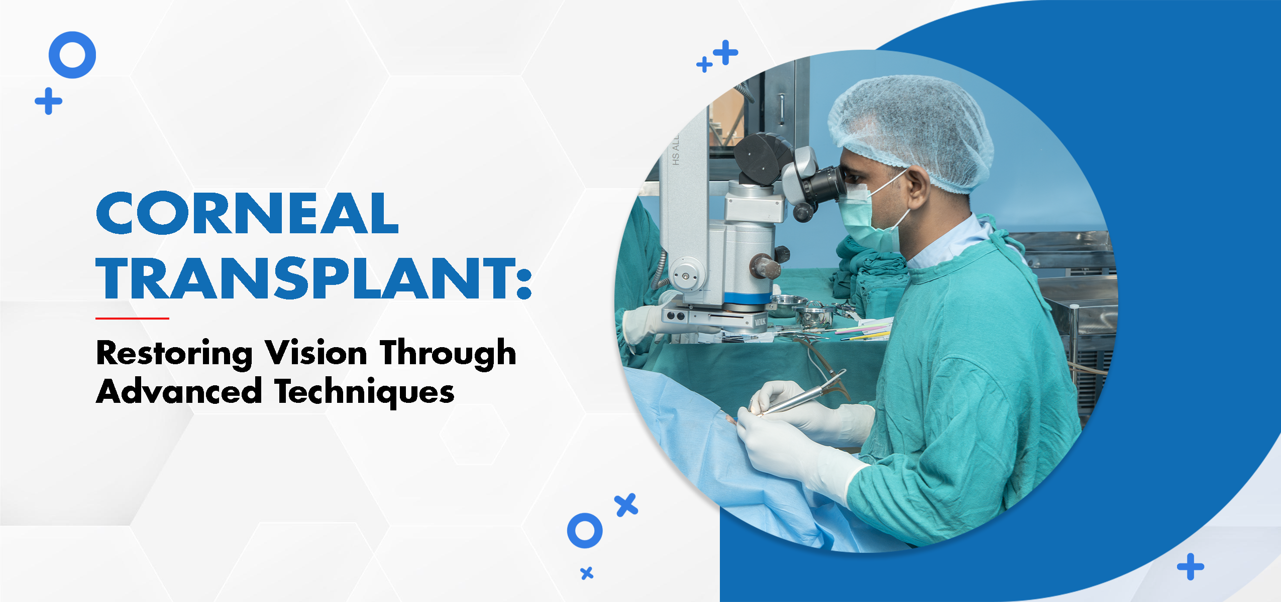 Corneal Transplant: Restoring Vision Through Advanced Techniques