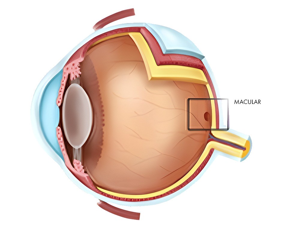 Understanding Age-Related Macular Degeneration (AMD)