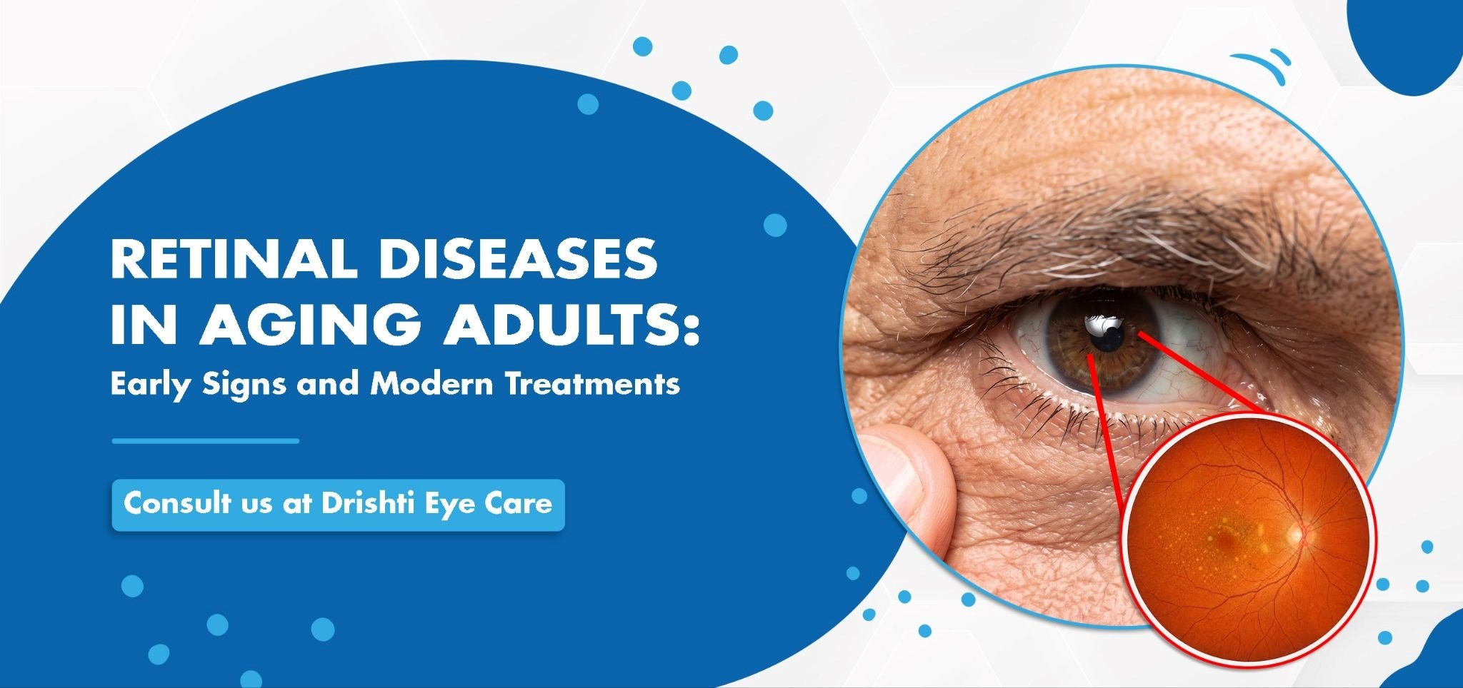 Retinal Diseases in Aging Adults: Early Signs and Modern Treatments | Drishti Eye Care System