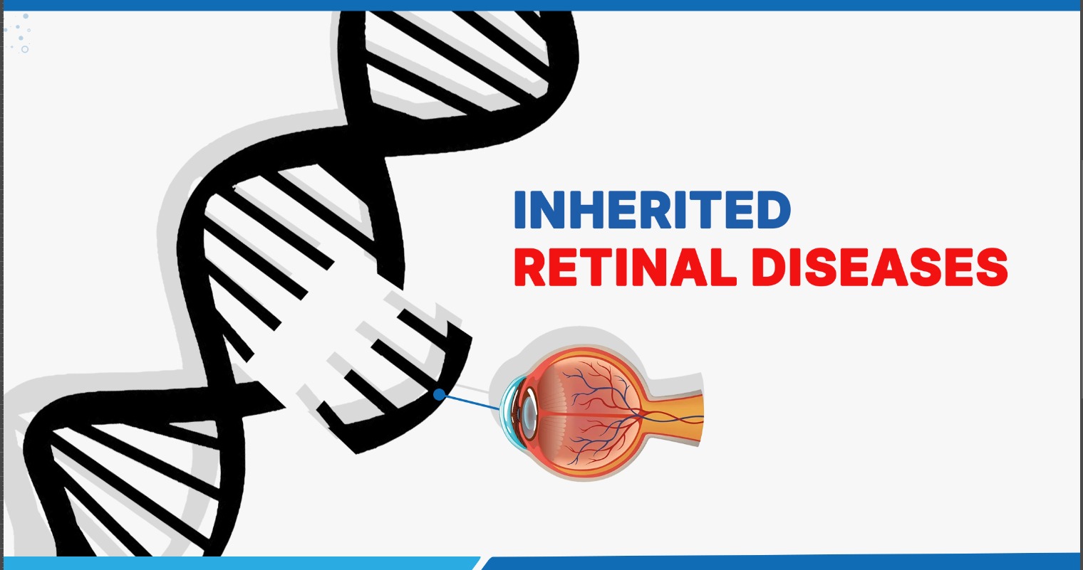 Understanding Inherited Retinal Diseases (IRD): Causes, Symptoms, Types, and Treatment