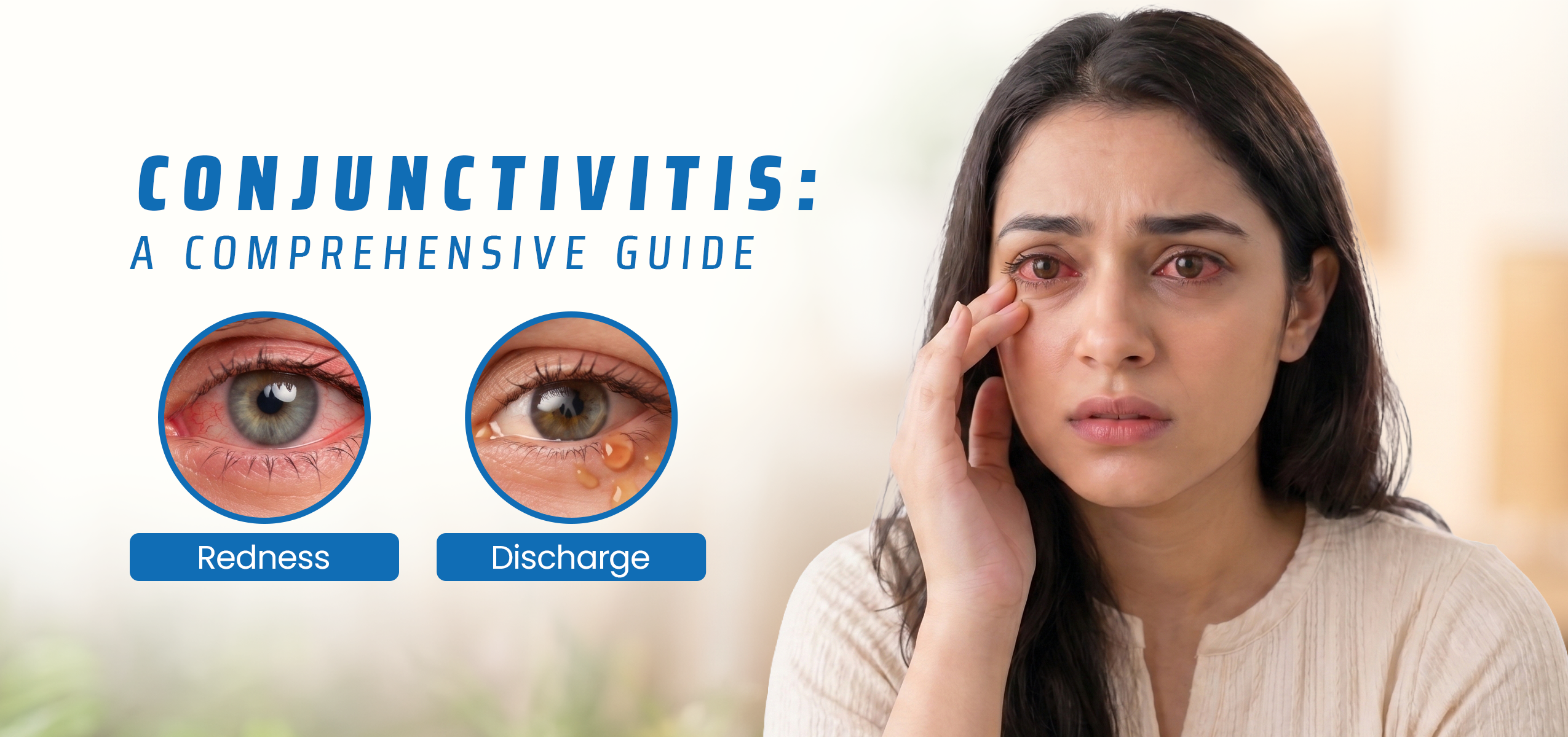 Conjunctivitis: A Comprehensive Guide