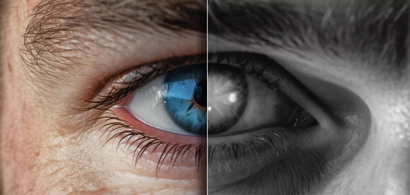 Understanding Glaucoma